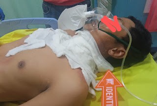Pemasang Spanduk Reklame Tewas Tersengat Listrik PLN di Simpang Unimed