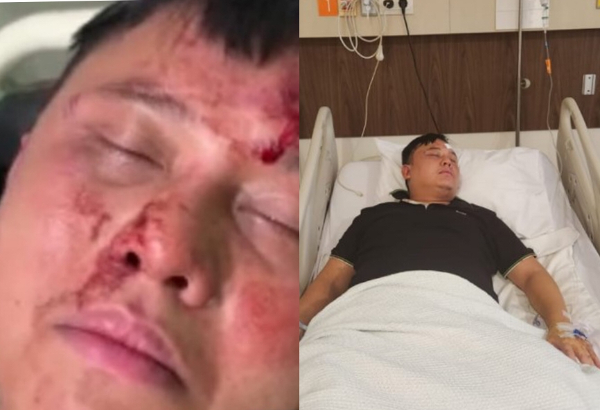 Dugaan Kasus Penyekapan dan Pengeroyokan, Owner Club Malam Hendra Koh Dilaporkan ke Polda Sumut
