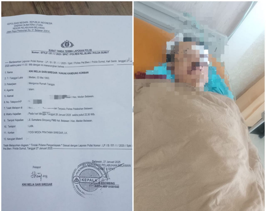 Pulang Kerja Dibacok OTK, Kakak Korban : Mohon Keadilannya Untuk Adik Saya
