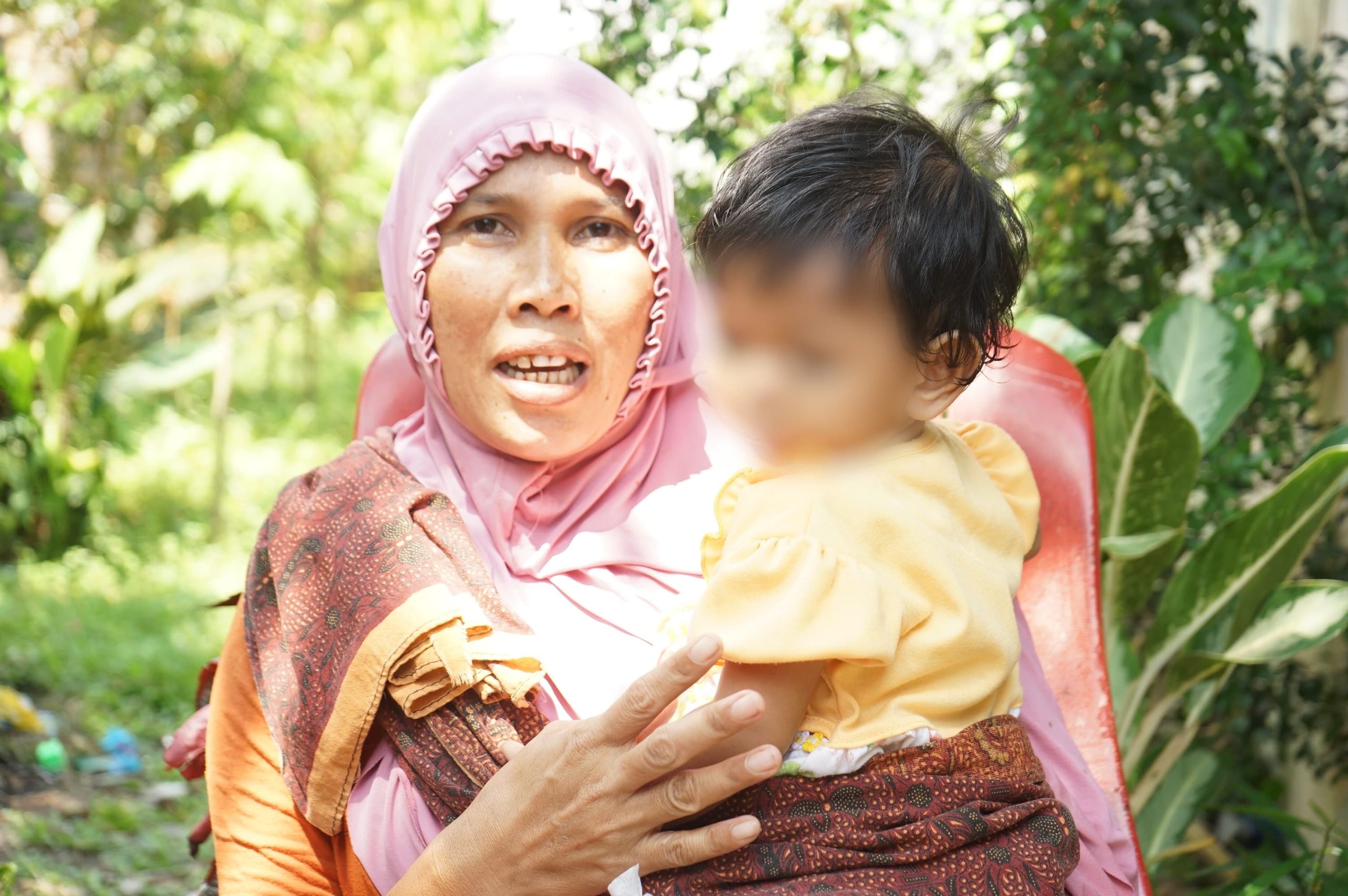 Senyum Salwa Kembali Merekah Usai Operasi, Berkat Bantuan Wali Kota Medan
