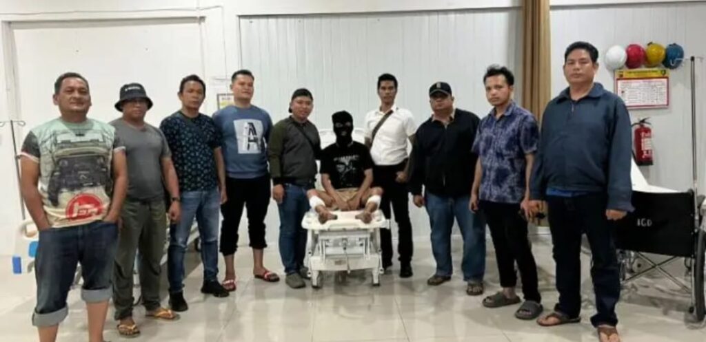 2 Peluru Polisi Bersarang di Kaki Pelaku Curanmor Kerap Beraksi di Plaza Medan Fair