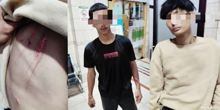 Dua Pelajar di Binjai Kena Sabetan Senjata Tajam Segerombolan Geng Motor