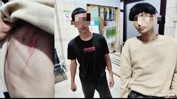Dua Pelajar di Binjai Kena Sabetan Senjata Tajam Segerombolan Geng Motor