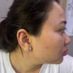 Tolak Pinjam Mobil, Dokter Kecantikan di Medan Dianiaya Kakak Kandung Diduga Mabuk