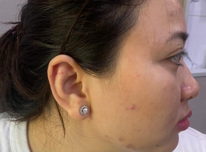 Tolak Pinjam Mobil, Dokter Kecantikan di Medan Dianiaya Kakak Kandung Diduga Mabuk