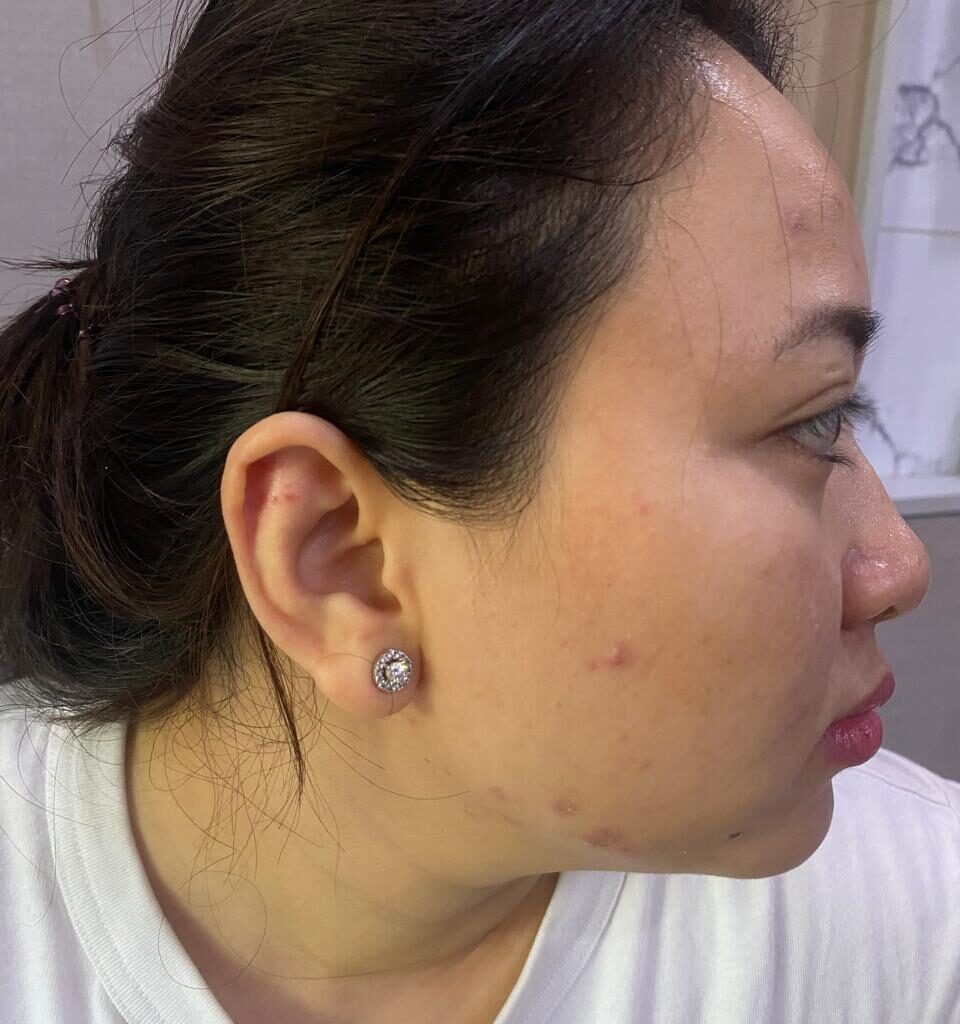 Tolak Pinjam Mobil, Dokter Kecantikan di Medan Dianiaya Kakak Kandung Diduga Mabuk