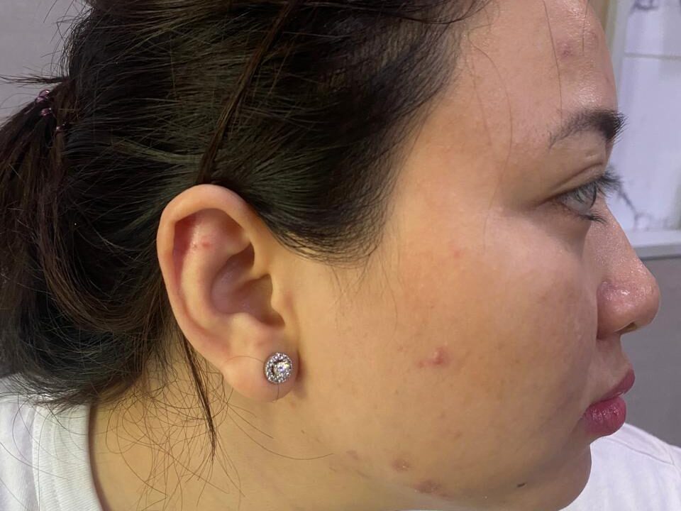 Tolak Pinjam Mobil, Dokter Kecantikan di Medan Dianiaya Kakak Kandung Diduga Mabuk