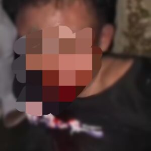 Remaja Diamankan Warga dalam Kondisi Babak Belur, Orang Tua Lapor Polisi