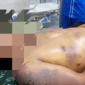Pria Asal Taput Tewas Diduga Dianiaya di Kawasan PTPN I Tanjung Morawa