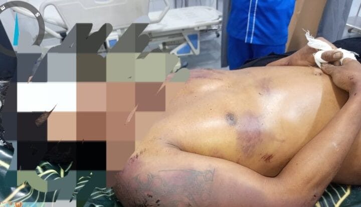 Pria Asal Taput Tewas Diduga Dianiaya di Kawasan PTPN I Tanjung Morawa