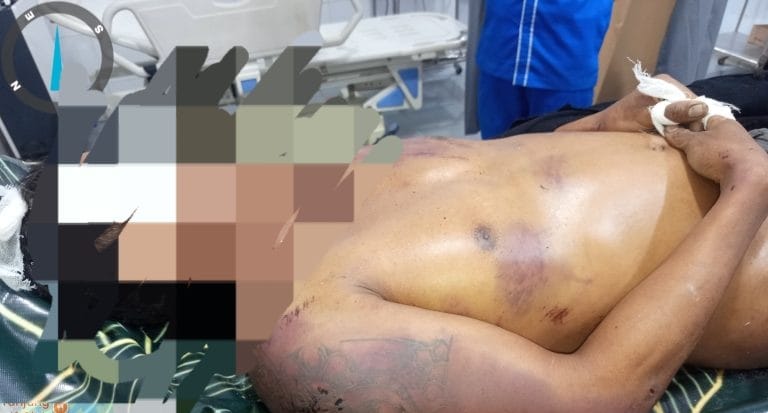 Pria Asal Taput Tewas Diduga Dianiaya di Kawasan PTPN I Tanjung Morawa