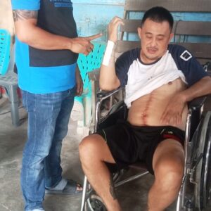 Ditembaki Kawanan Bersenpi, Korban di Tanjung Morawa Minta Polda Sumut Ambil Alih Kasus