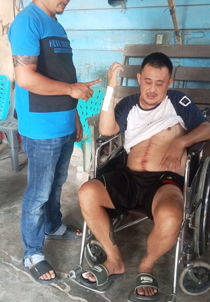 Ditembaki Kawanan Bersenpi, Korban di Tanjung Morawa Minta Polda Sumut Ambil Alih Kasus