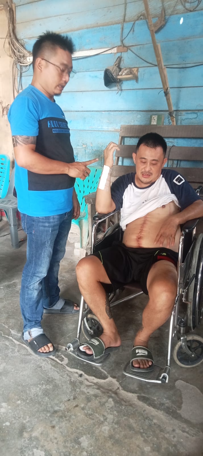 Ditembaki Kawanan Bersenpi, Korban di Tanjung Morawa Minta Polda Sumut Ambil Alih Kasus